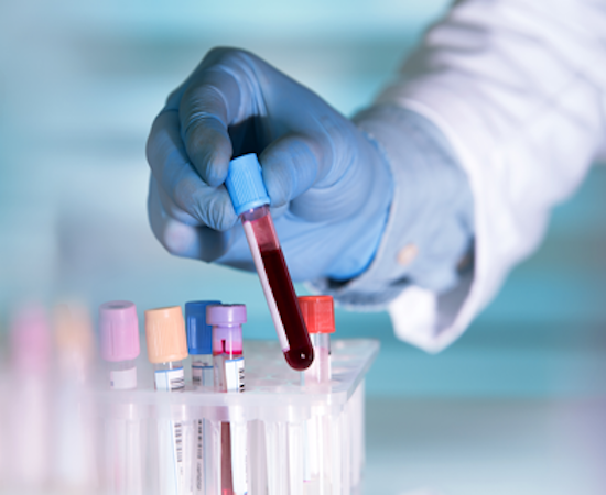 Laboratory technician testing a blood sample